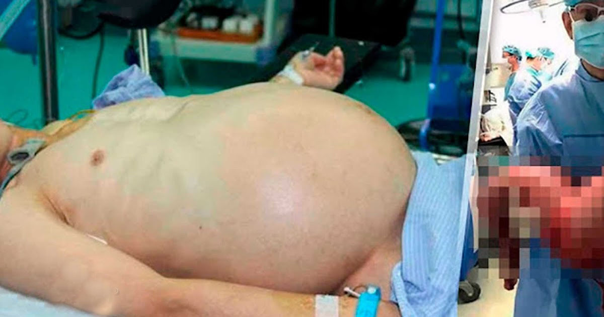 la-historia-del-hombre-afirmando-que-algo-crecia-dentro-de-el-y-nadie-le-creyo-pero-9-meses-despues