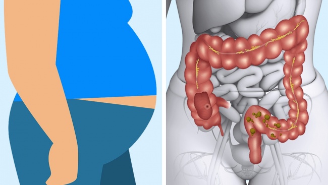 estas-son-las-9-senales-que-nos-dicen-que-nuestro-cuerpo-pudiera-no-digerir-adecuadamente-la-carne-008