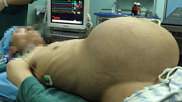 la-historia-del-hombre-afirmando-que-algo-crecia-dentro-de-el-y-nadie-le-creyo-pero-9-meses-despues-002