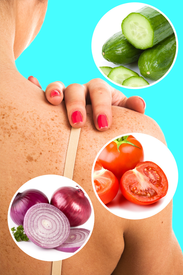 los-utiles-consejos-para-deshacerte-de-las-manchas-solares-en-la-piel-con-remedios-naturales-001