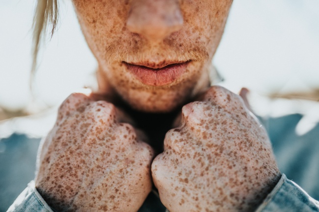 sigue-estos-consejos-si-tienes-labios-secos-y-agrietados--009